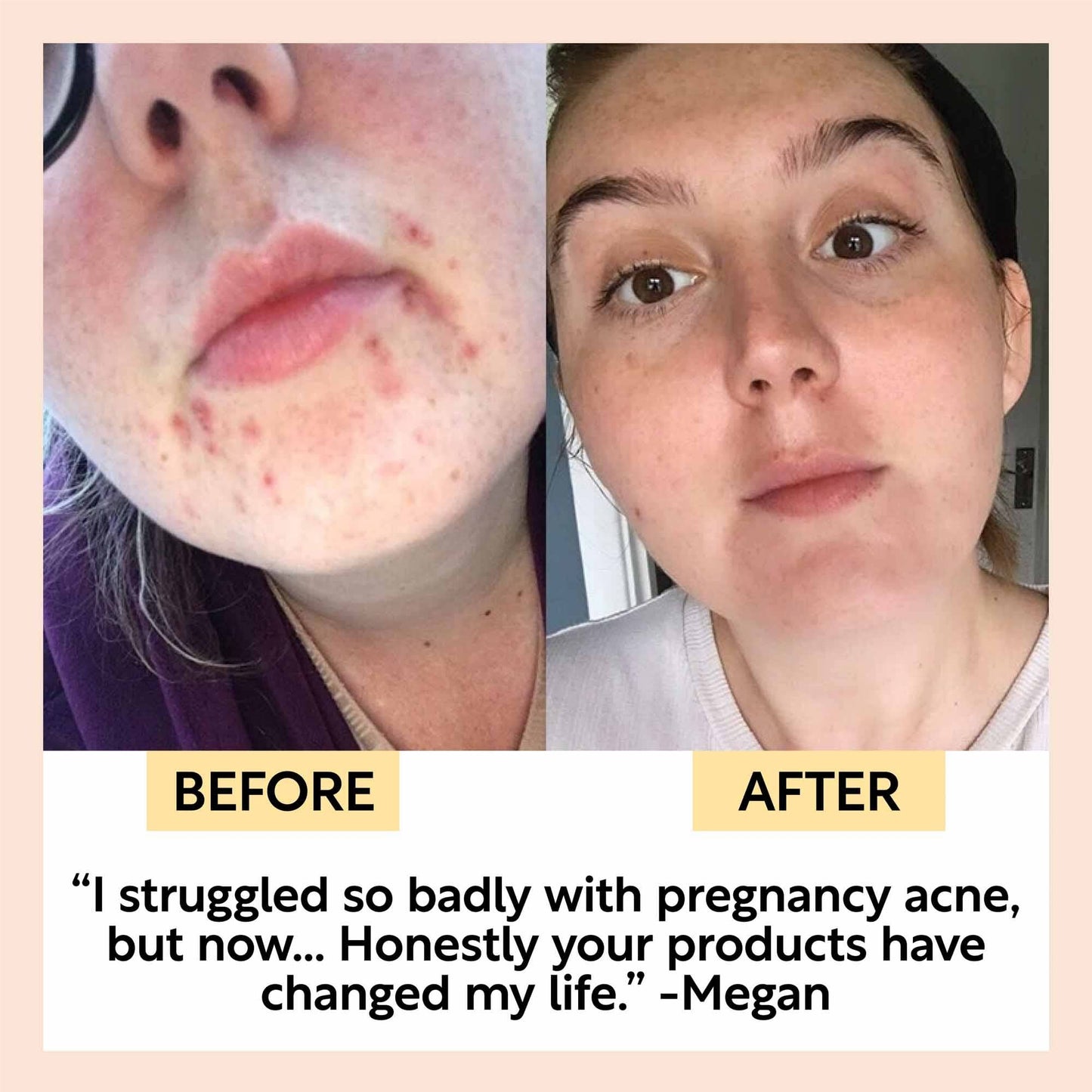 Face Moisturizer with Vitamin E